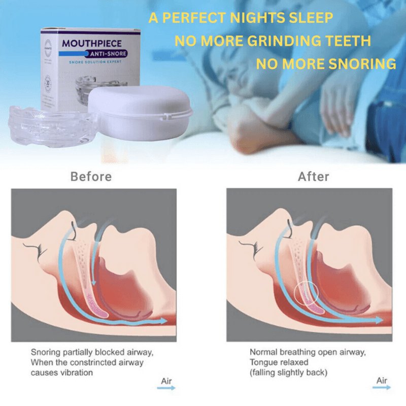 PureBreathHealth™ Stop Snoring Sleeping Aid